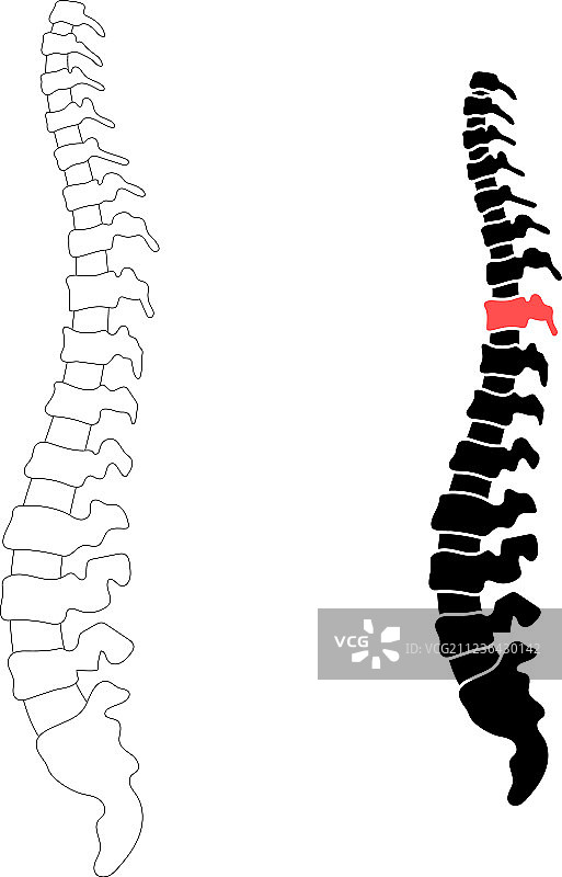 脊椎疼痛图片素材
