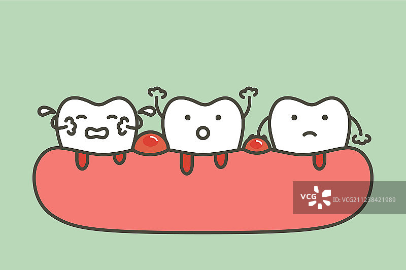 牙周炎或牙龈疾病伴出血图片素材