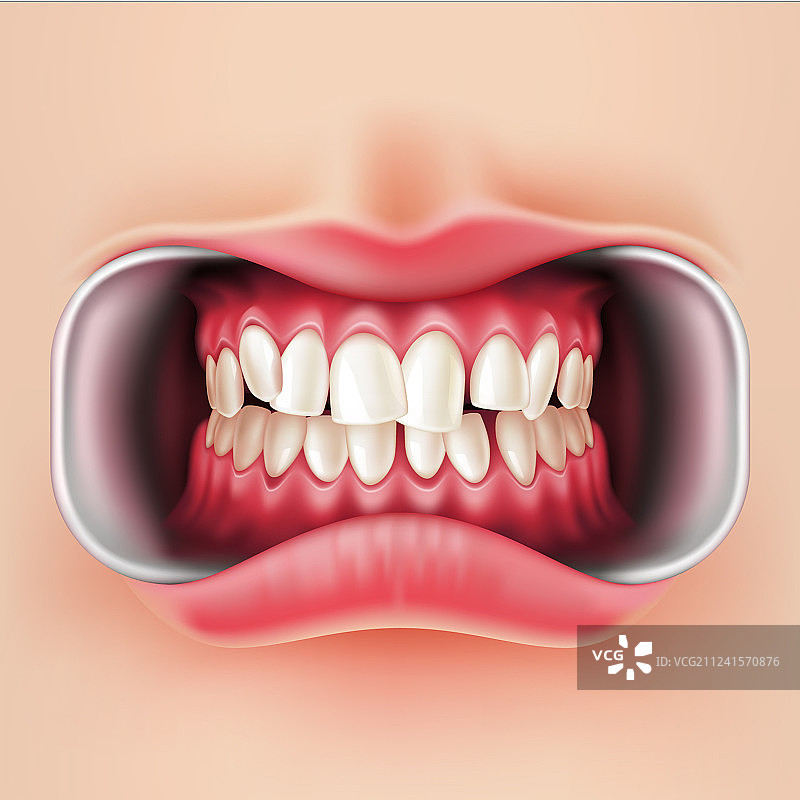 口腔支架系统3d图片素材