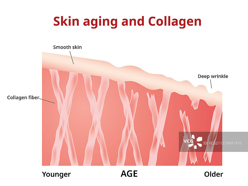 皮肤老化胶原蛋白在年轻和年老的皮肤图片素材