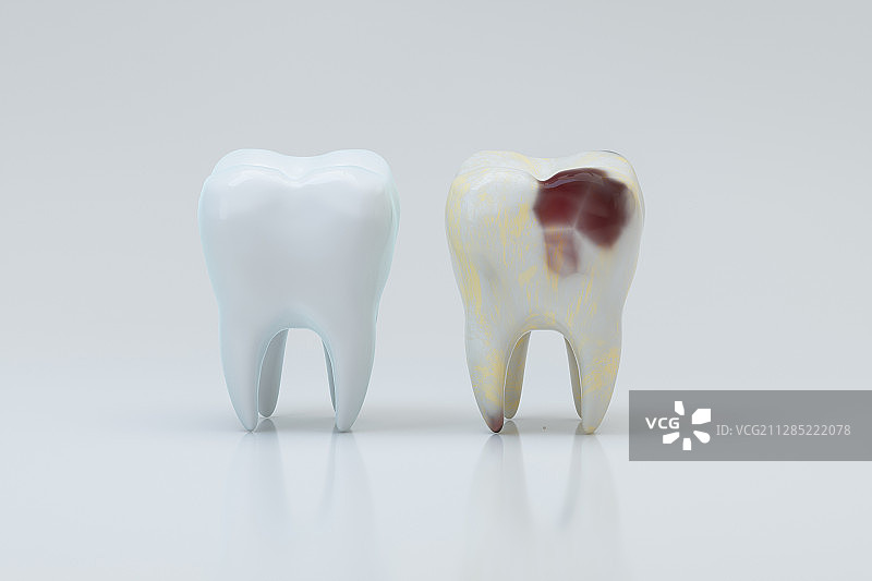 蛀牙与旁边好的牙齿 3D渲染图片素材