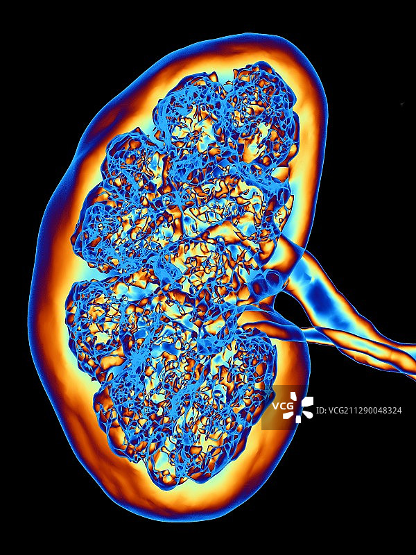 肾脏,CT扫描图片素材