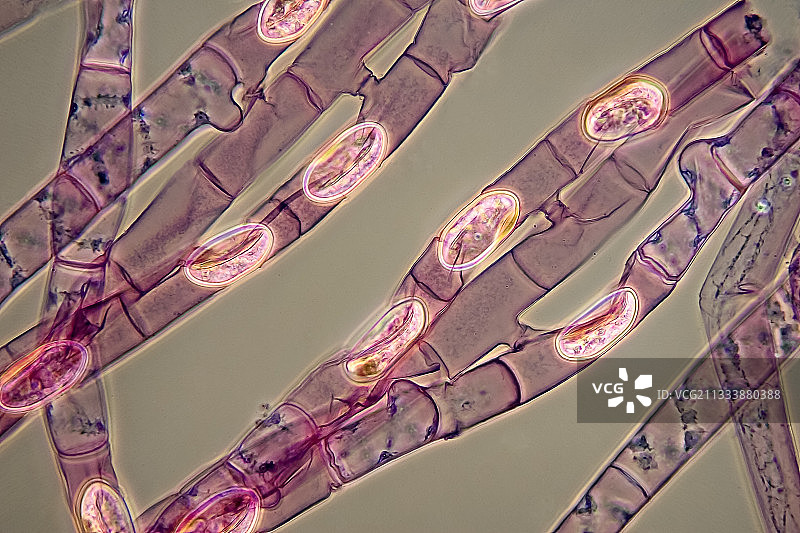 水蛭孢子的细节图片素材