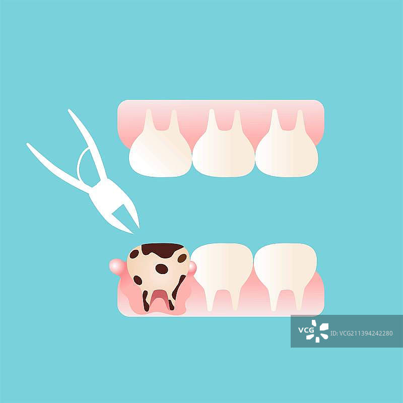 口腔卫生拔蛀牙插画海报图片素材