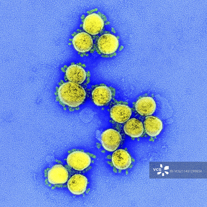 新型冠状病毒，透射电镜图片素材