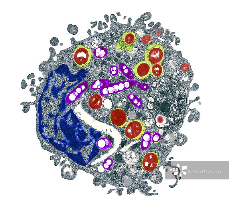 巨噬细胞与细菌，TEM图片素材