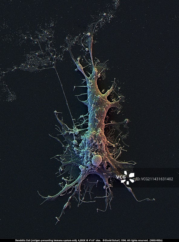 树突状免疫细胞彩色扫描电镜图片素材