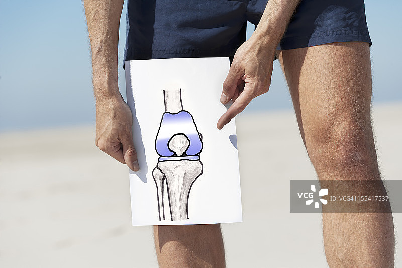 全膝关节置换图片素材