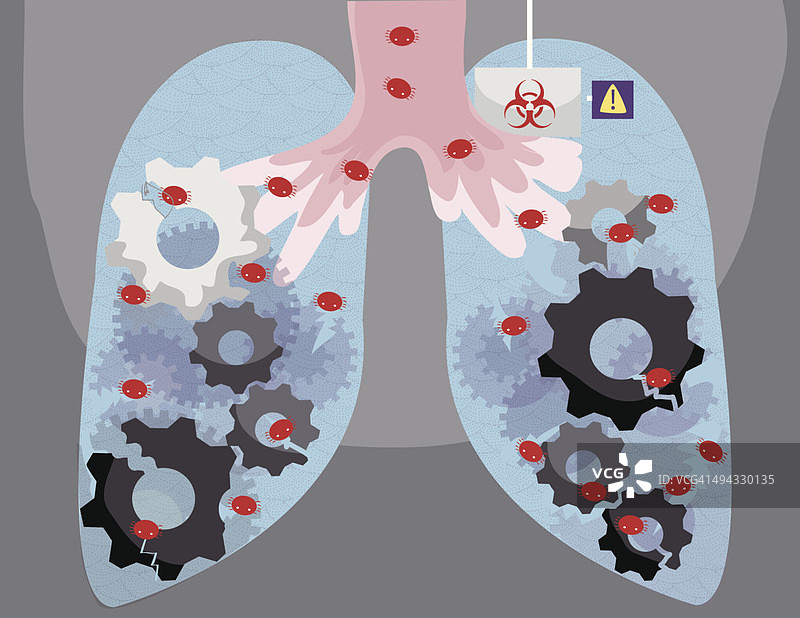 图示人类肺部感染病毒图片素材