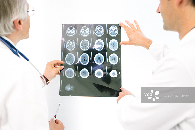 医生会通过大脑的核磁共振扫描进行咨询图片素材