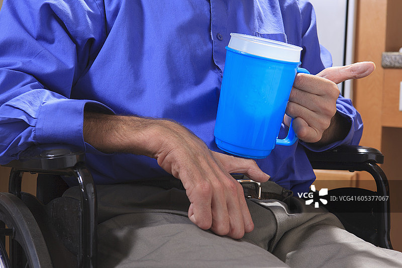 患有共济失调症的男子用他畸形的双手端着一杯水图片素材