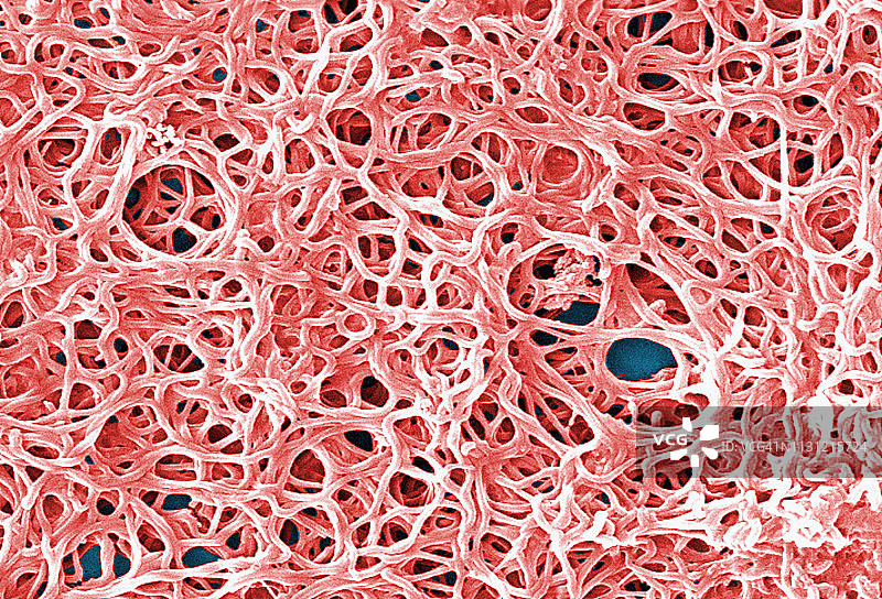 伯氏疏螺旋体细菌(莱姆病)图片素材