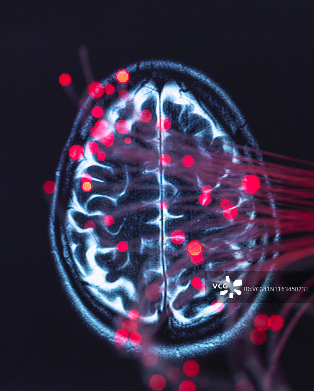 神经科学，携带大脑数据的光纤图片素材