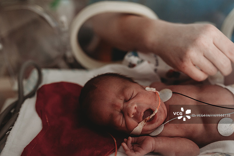 母亲协助新生儿重症监护室早产儿，同时在Isolette用氧气和喂食管图片素材