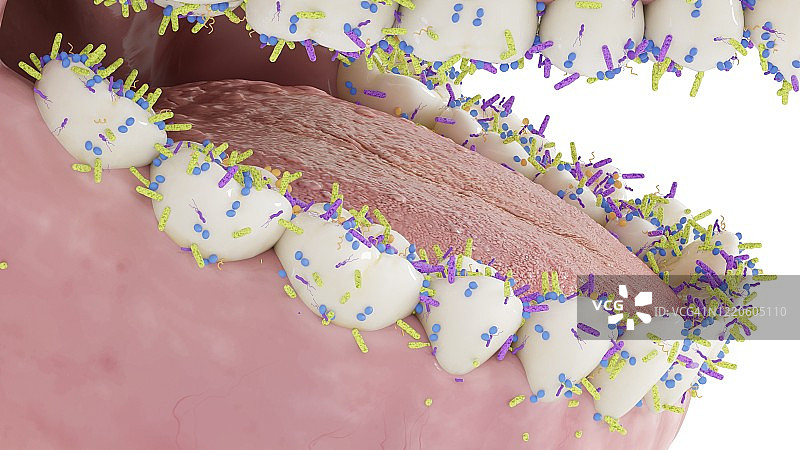 牙齿上的细菌，插图图片素材