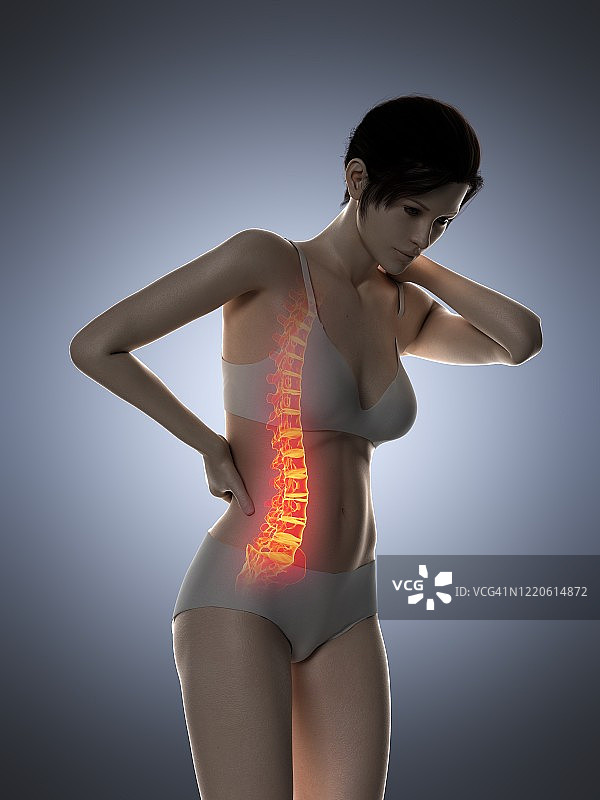 背部疼痛的女人，插图图片素材