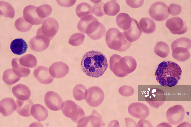 淋巴细胞，中性粒细胞和嗜酸性粒细胞——三种不同类型的白细胞或白细胞，400X图片素材