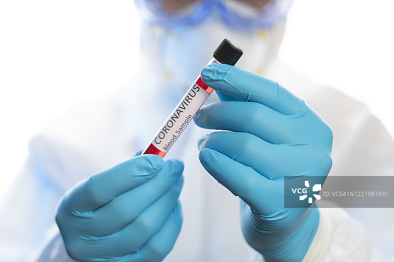 血液研究科学家，冠状病毒2019-nCoV血液样本。冠状病毒发作有。流行性病毒呼吸综合征。图片素材
