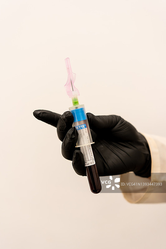 在美容中心，护士、医生或医疗技术人员手的特写，戴着黑色手套，用注射器注射客户的血液样本图片素材