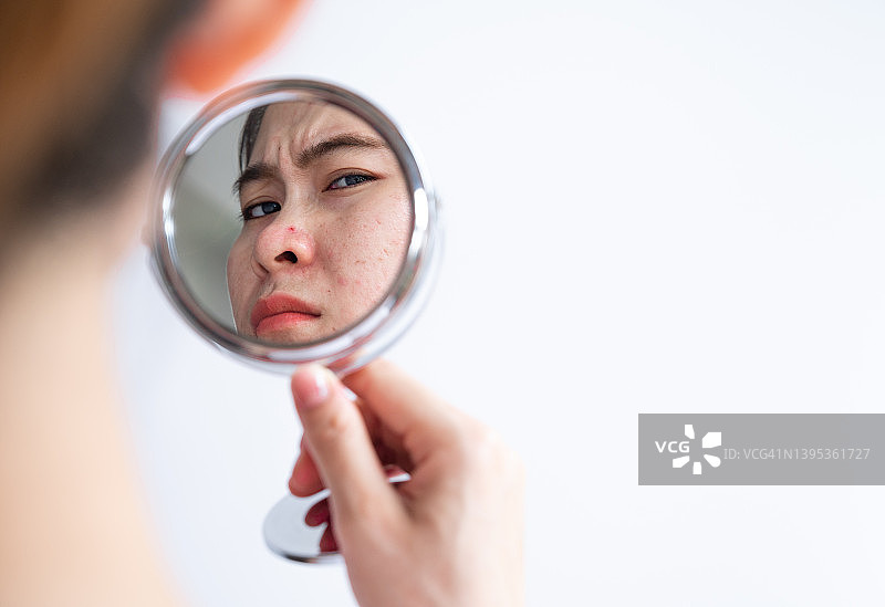 亚洲妇女担心她的脸，当她看到痤疮的问题发生在她的脸由迷你镜。图片素材