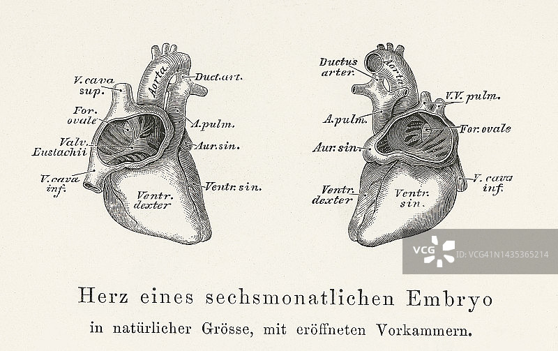 人体心脏解剖的古老雕刻插图-心脏的一个六个月的胚胎图片素材