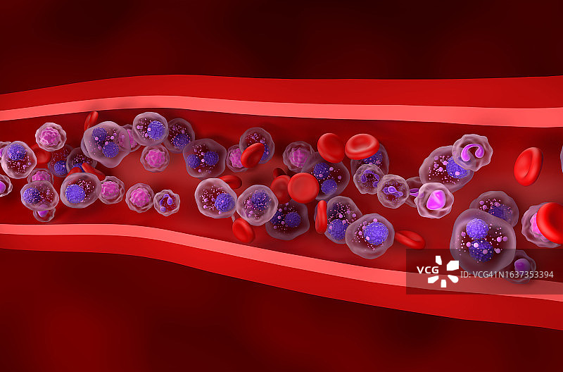 多发性骨髓瘤细胞在血流中聚集-等距视图三维插图图片素材
