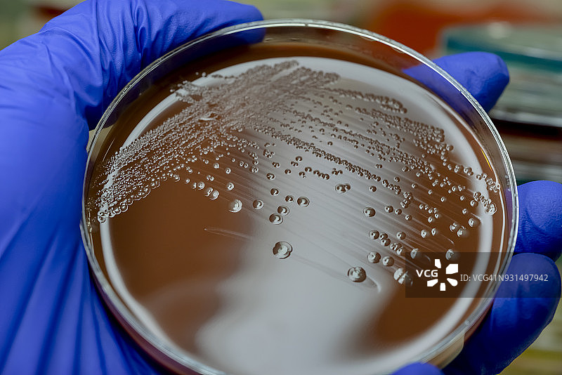 巧克力琼脂平板上的流感嗜血杆菌菌落图片素材