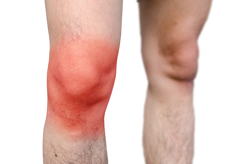 在白色背景下站立的膝盖疼痛的男人的腹部图片素材