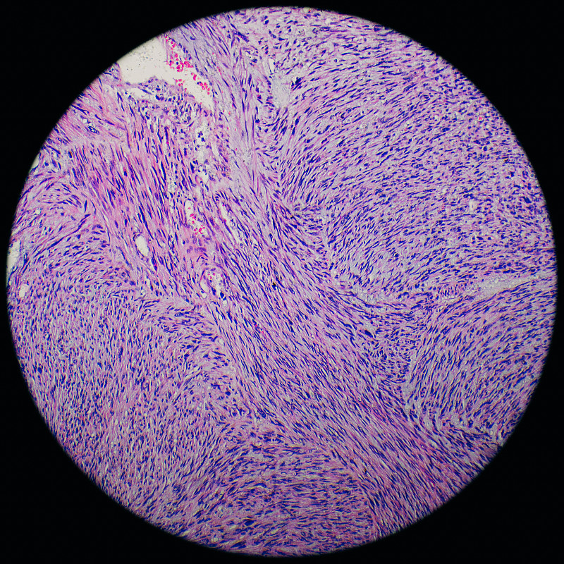 平滑肌细胞显微镜图片