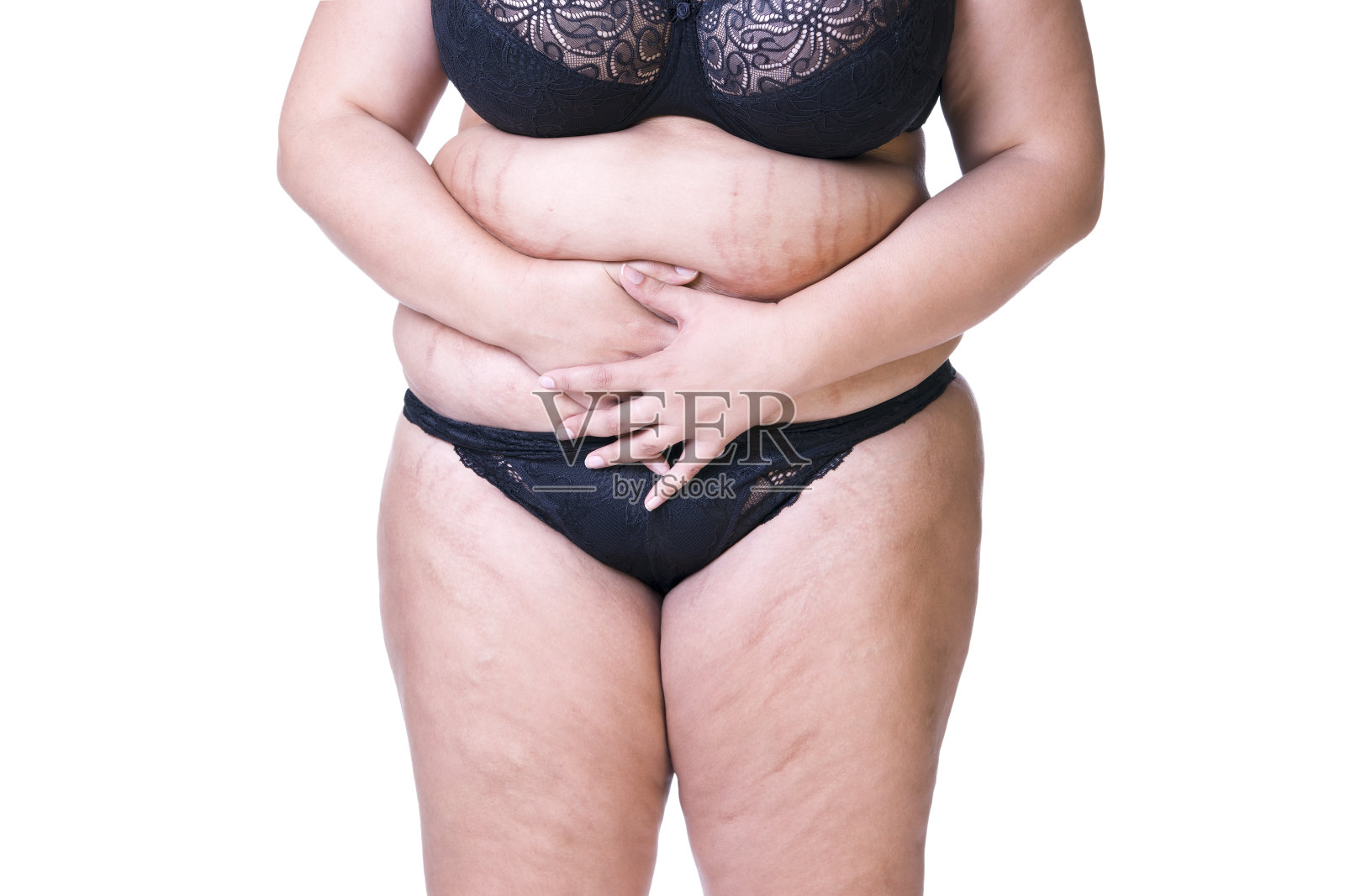 女性怀孕后腹部肥胖，妊娠纹特写照片摄影图片