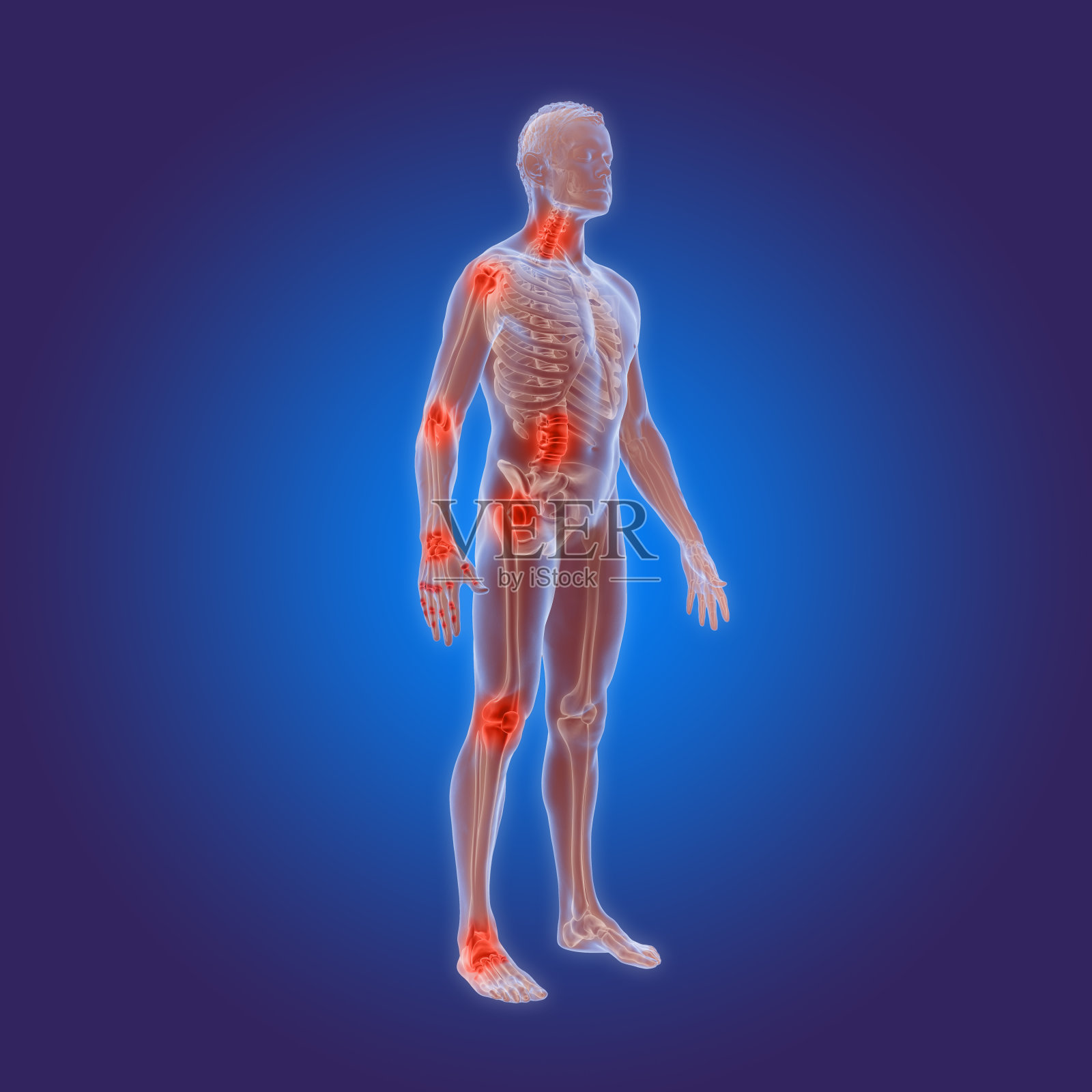 骨关节炎的3D渲染-类风湿性关节炎在人体照片摄影图片