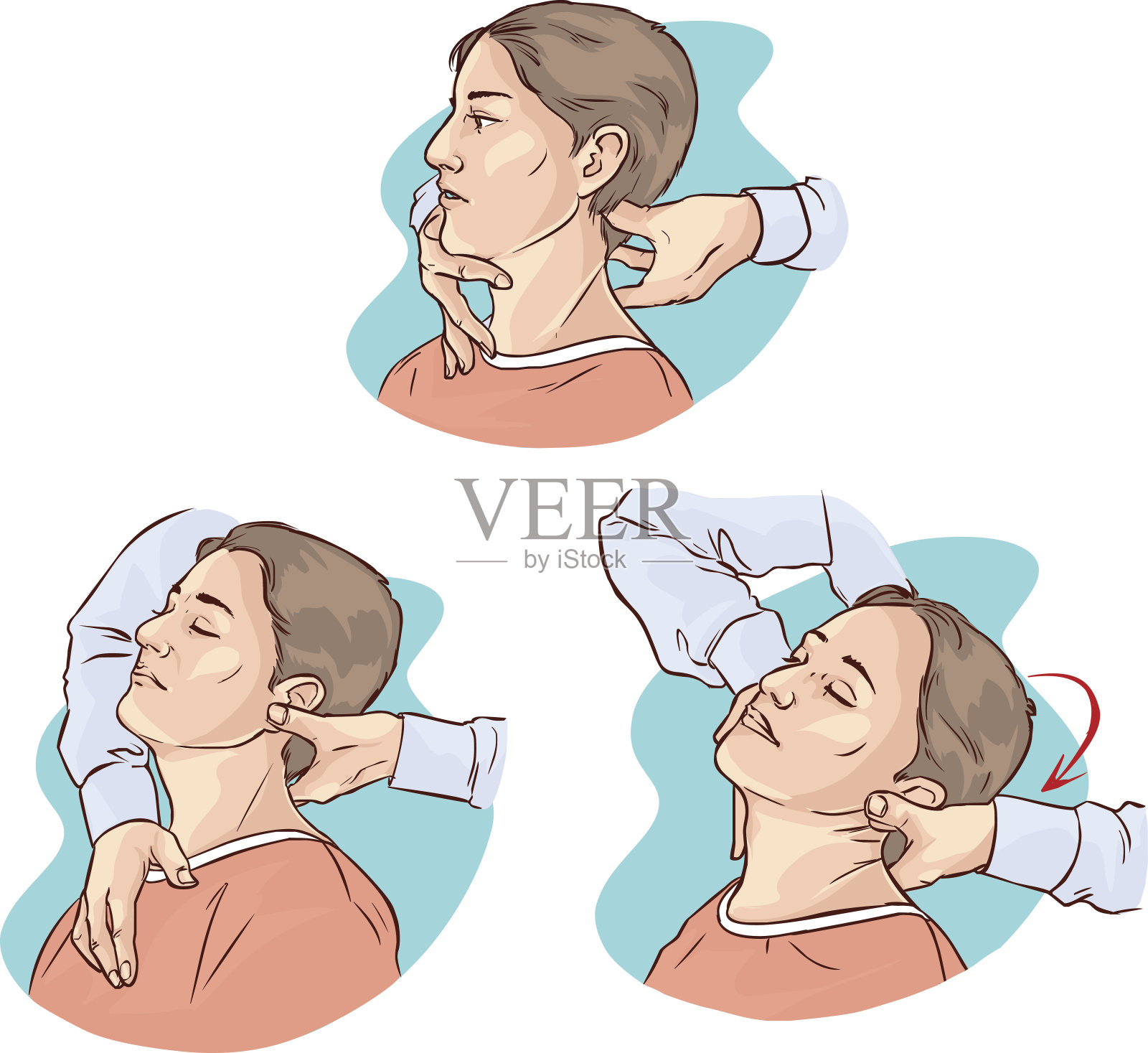 矢状插图的冈斯特德脊骨治疗急性颈痛插画图片素材