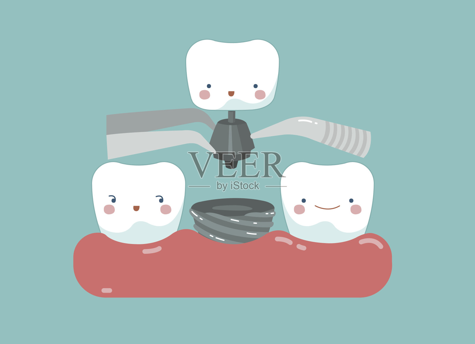 牙种植、牙和牙的概念插画图片素材