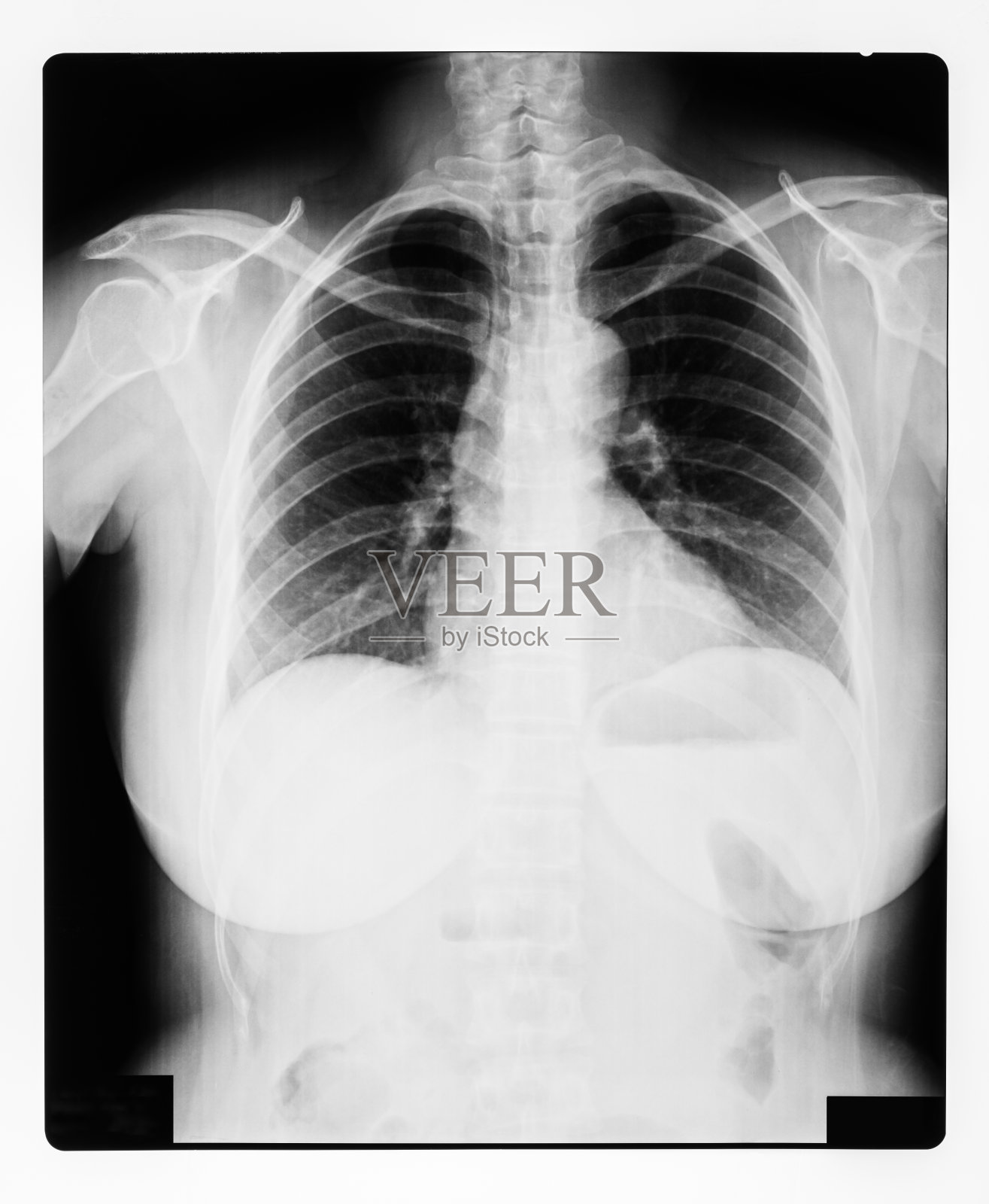 用于医学诊断的人体胸部的黑白x光图像照片摄影图片