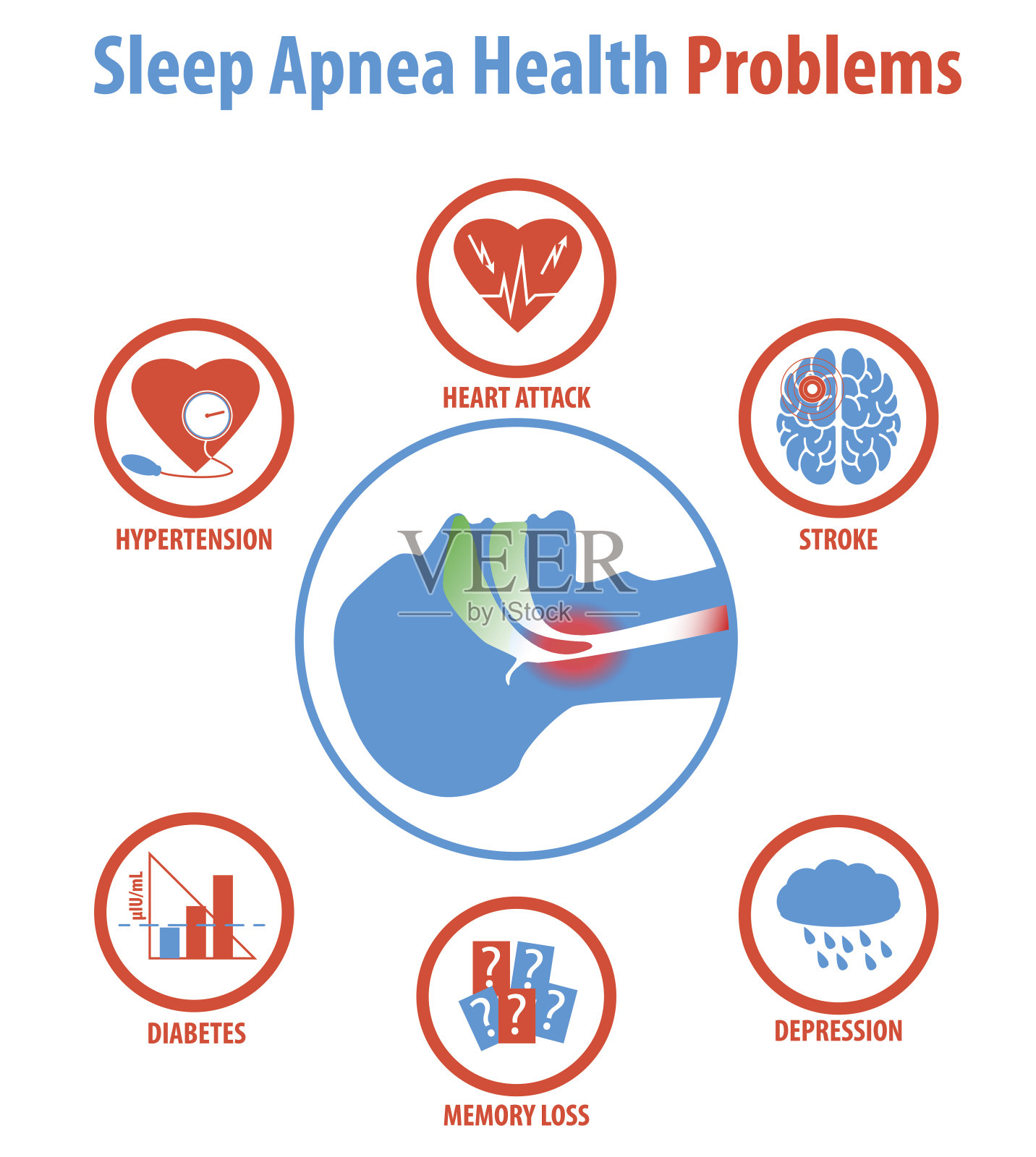 睡眠呼吸暂停:治疗、原因、症状和健康问题。插画图片素材