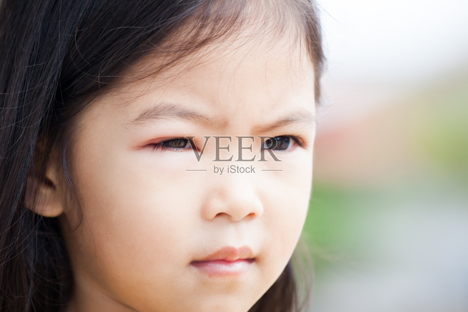 亚洲儿童女孩眼睛肿胀的特写细菌病毒照片摄影图片