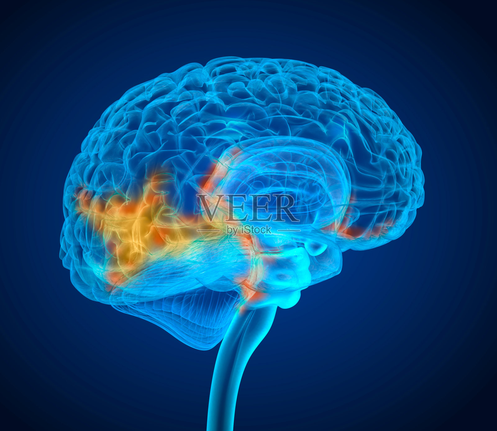 人脑肿瘤x射线扫描，医学上精确的3D插图照片摄影图片