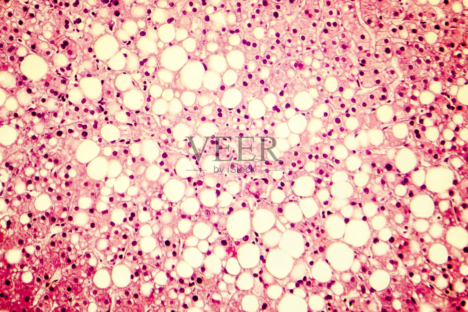 脂肪肝的光学显微镜照片照片摄影图片