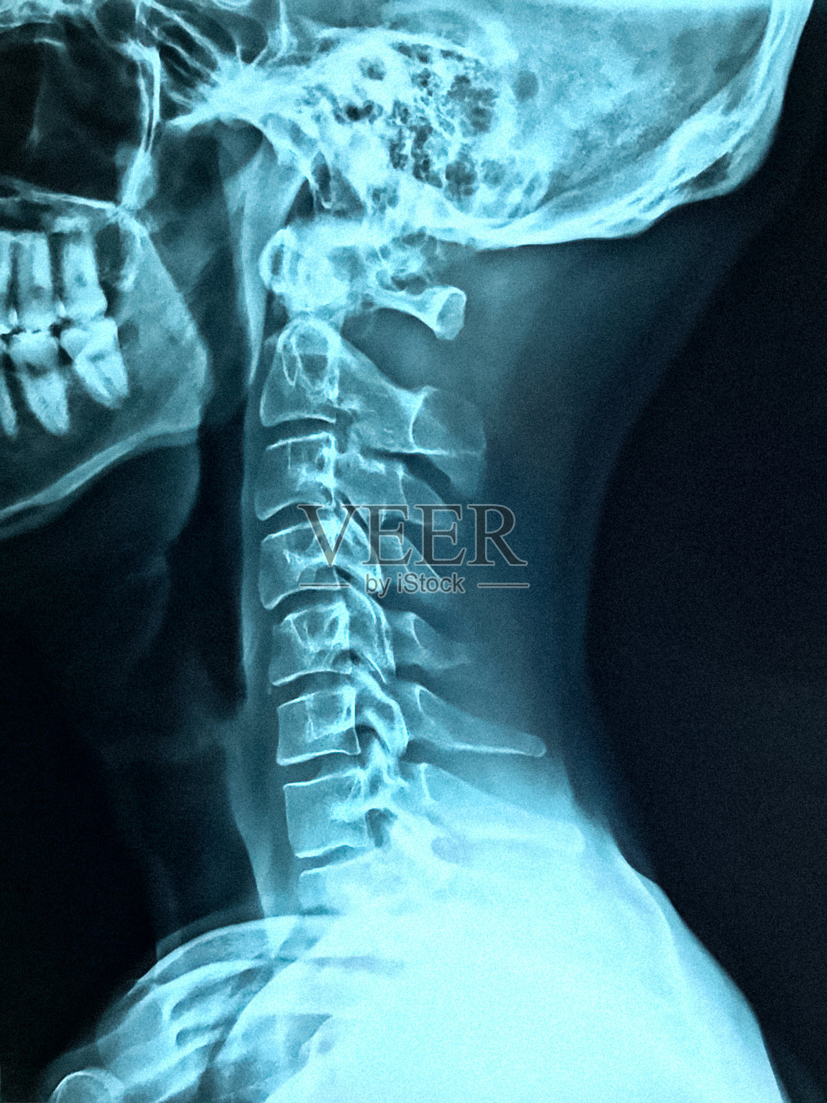 x射线的脖子照片摄影图片