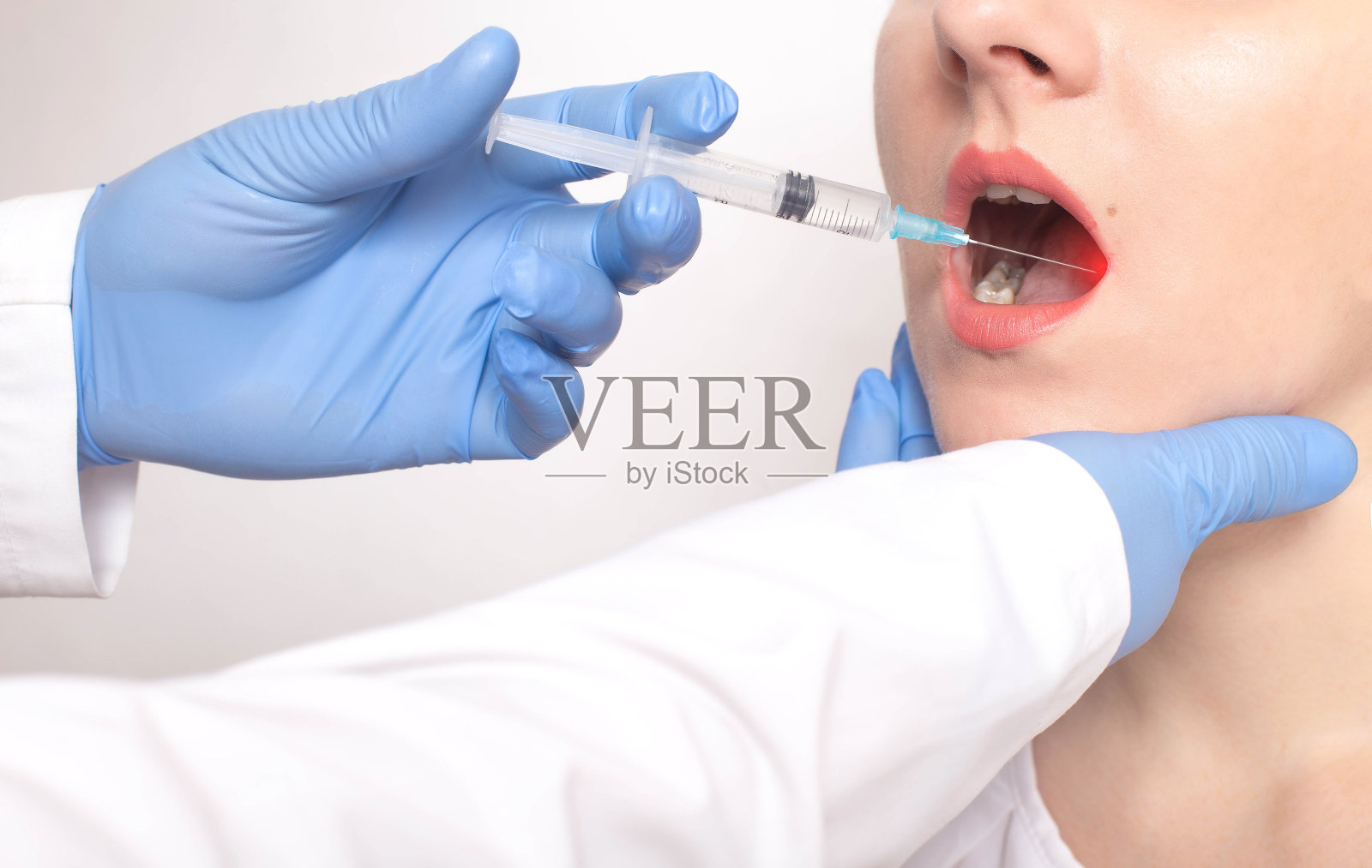 医生用注射器在病人的舌头上做舌活检。概念检查良恶性肿瘤、舌癌、病照片摄影图片