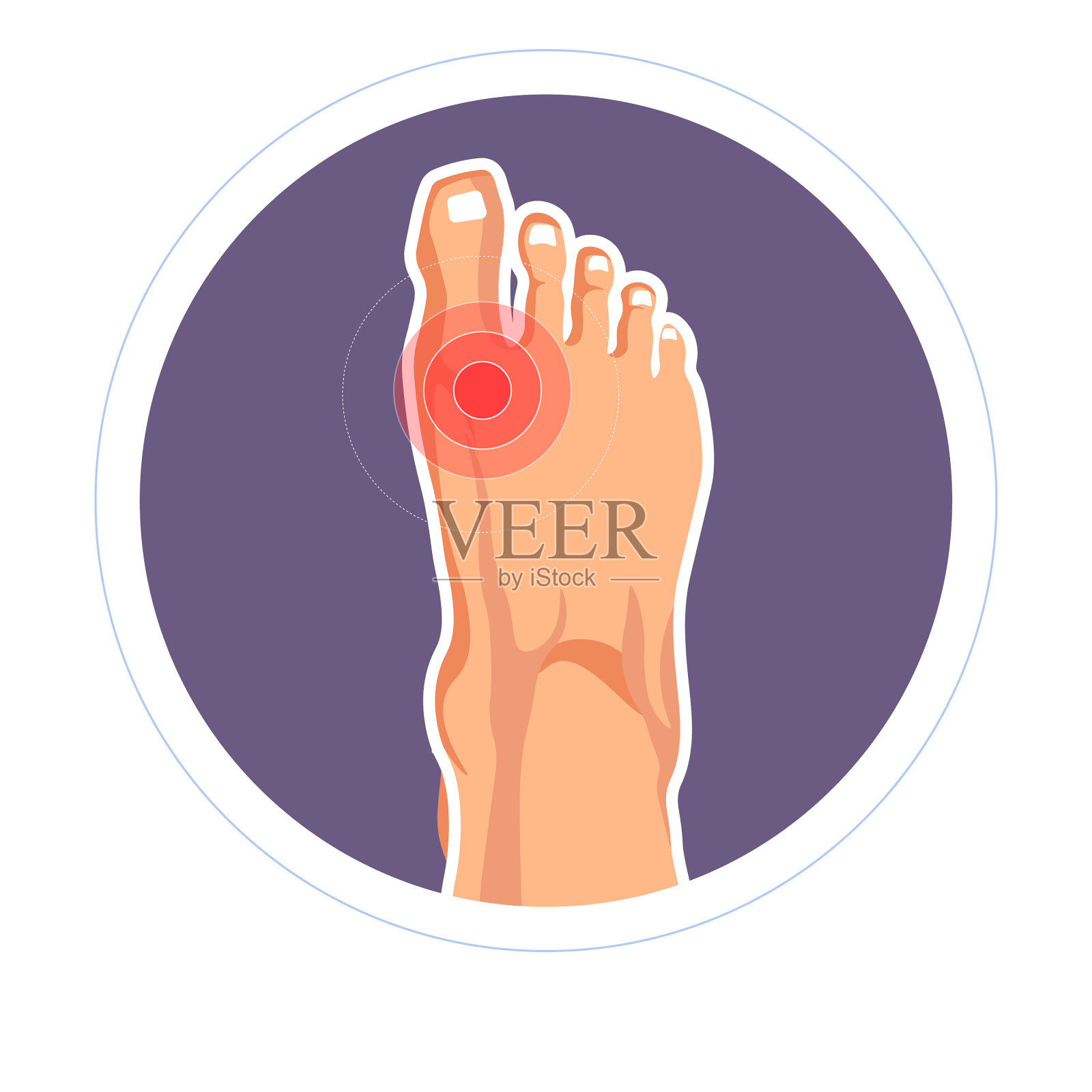 大脚趾关节疼痛的 5 个常见原因 - 知乎