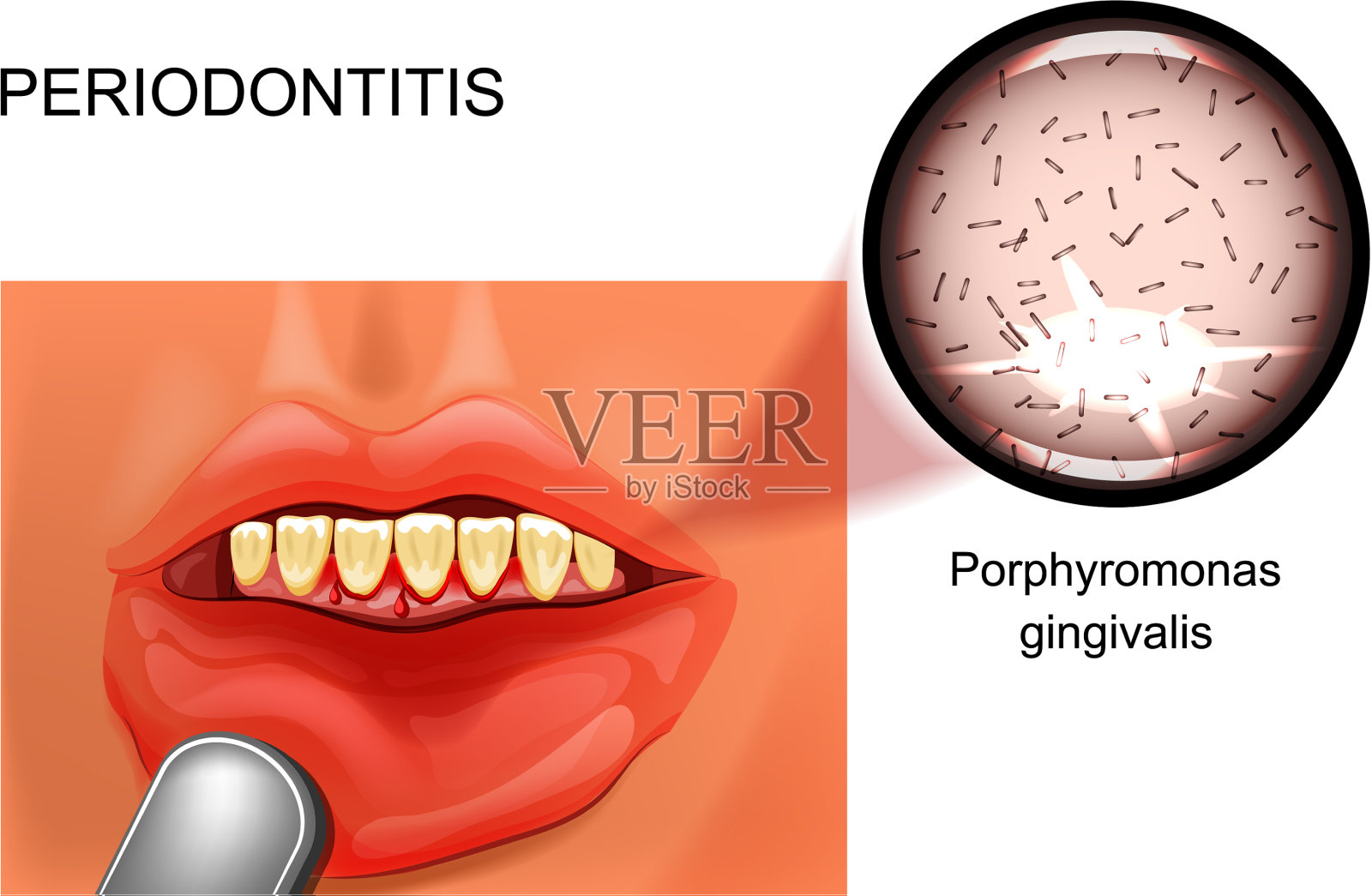 PPT - 第五章 牙周病的主要症状和病理 PowerPoint Presentation - ID:6938033