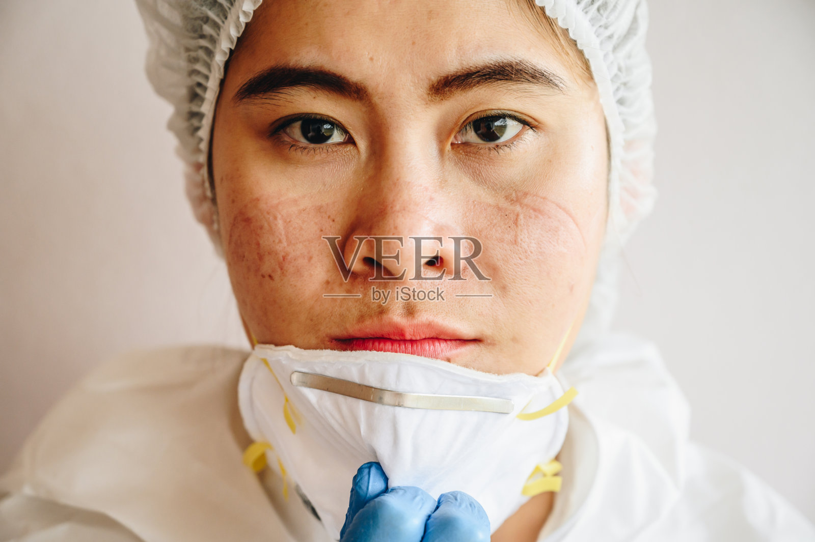 covid-19大流行期间长期住院的医护人员，因佩戴医用口罩而造成面部创伤。照片摄影图片