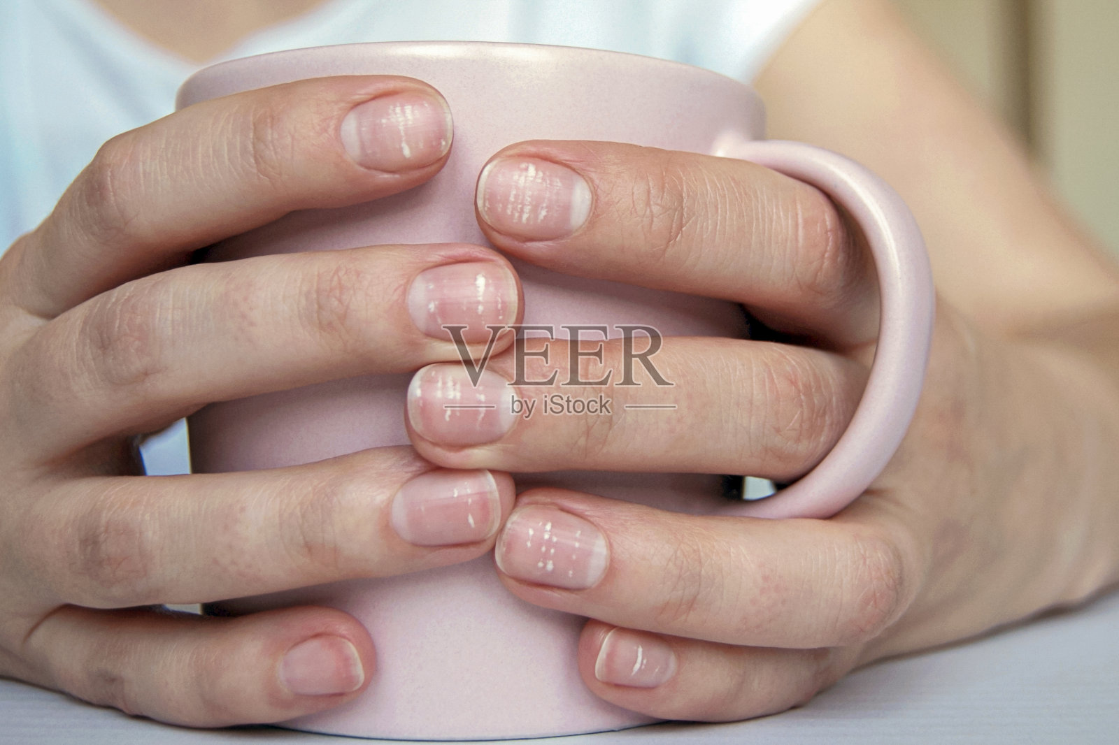 指甲上有许多白色斑点(白甲病)是由于缺钙或压力造成的。女性手握杯照片摄影图片